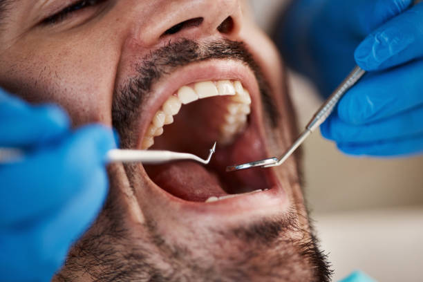 Best Walk-In Emergency Dentist in Guymon, OK